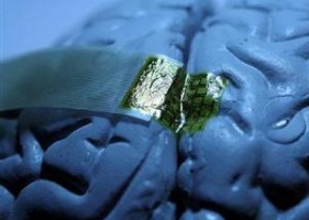 Новые нейронные импланты способны мыслить